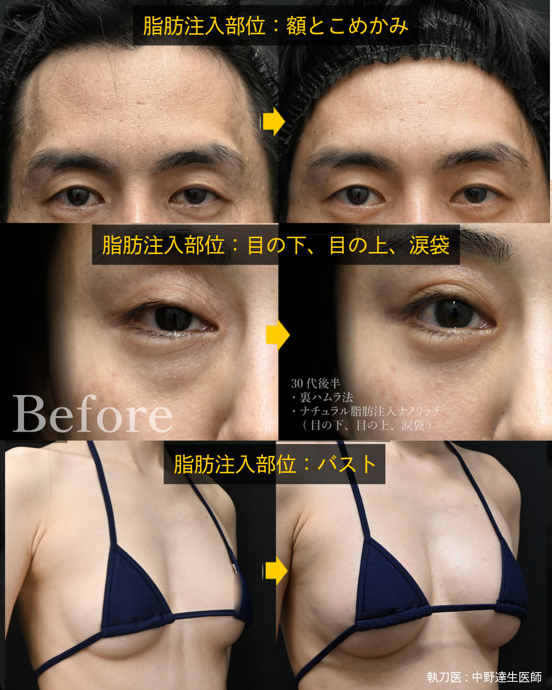 脂肪吸引だけじゃない！！
